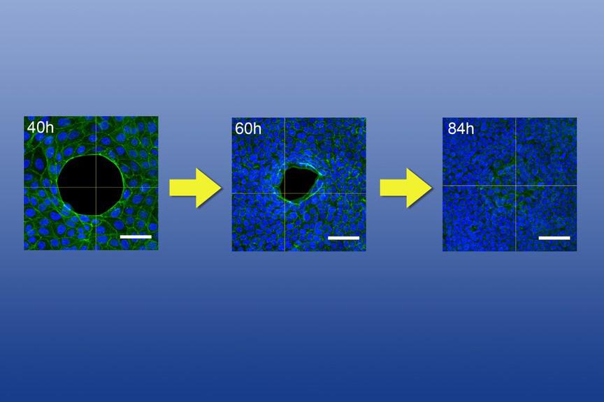 A previously unexplored mechanism of wound gap closure similar to zipping a purse string may offer faster and better healing